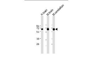 All lanes : Anti-SLC1A3 Antibody (N-Term) at 1:8000 dilution Lane 1: Human brain lysate Lane 2: Mouse brain lysate Lane 3: Mouse cerebellum lysate Lysates/proteins at 20 μg per lane.