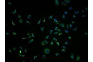 Immunofluorescence staining of SH-SY5Y cells with ABIN7139960 at 1:100, counter-stained with DAPI.