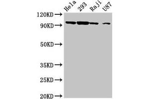 Western Blot Positive WB detected in: Hela whole cell lysate, 293 whole cell lysate, Raji whole cell lysate, U87 whole cell lysate All lanes: MASTL antibody at 6. (MASTL anticorps  (AA 612-740))