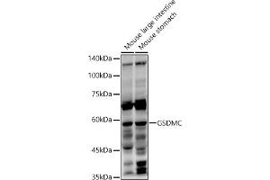 Western blot analysis of extracts of various cell lines, using GSDMC antibody (ABIN7268463) at 1:1000 dilution. (MLZE anticorps  (AA 1-100))