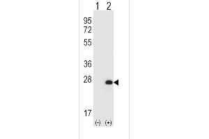 Western blot analysis of HPRT1 (arrow) using rabbit polyclonal HPRT1 Antibody (N-term) (ABIN652234 and ABIN2840981). (HPRT1 anticorps  (N-Term))