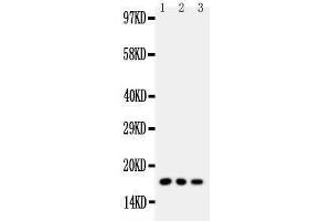 Western Blotting (WB) image for anti-Caveolin 2 (CAV2) (AA 1-17), (N-Term) antibody (ABIN3042683) (Caveolin 2 anticorps  (N-Term))
