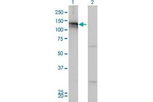Western Blot analysis of AXL expression in transfected 293T cell line by AXL monoclonal antibody (M01), clone 6C8.