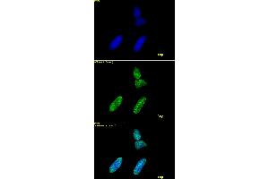 Histone H3 acetyl Lys9 antibody tested by immunofluorescence. (Histone 3 anticorps  (acLys9))