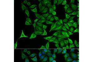 Immunofluorescence analysis of HeLa cells using KRT20 Polyclonal Antibody (KRT20 anticorps)