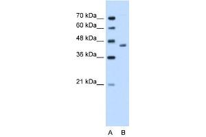 ADH1B antibody used at 1.