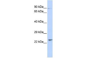 LRRC51 antibody used at 1 ug/ml to detect target protein.