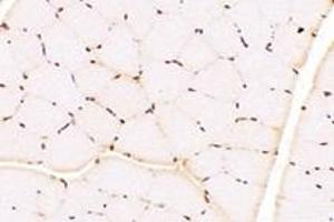 Immunohistochemistry analysis of paraffin-embedded rat muscle using,TBX10 (ABIN7075814) at dilution of 1: 4600