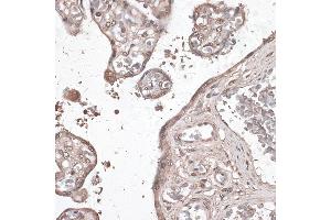 Immunohistochemistry of paraffin-embedded human placenta using MEF2C antibody (ABIN6132345, ABIN6143716, ABIN6143717 and ABIN6215998) at dilution of 1:100 (40x lens).