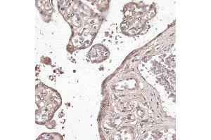 Immunohistochemistry of paraffin-embedded human placenta using MEF2C antibody (ABIN6132345, ABIN6143716, ABIN6143717 and ABIN6215998) at dilution of 1:100 (40x lens). (MEF2C anticorps  (AA 170-380))