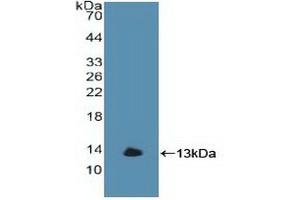 Western blot analysis of recombinant Human GbA. (GBA anticorps  (AA 117-214))