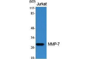 Western Blot (WB) analysis of specific cells using MMP-7 Polyclonal Antibody.
