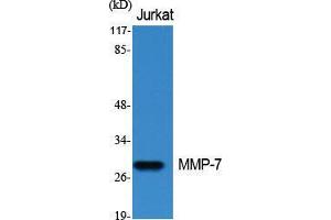 Western Blot (WB) analysis of specific cells using MMP-7 Polyclonal Antibody. (MMP7 anticorps  (C-Term))