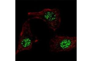 IF staining of HeLa cells with KLF4 antibody at 1:100, response is localized to the nuclei.