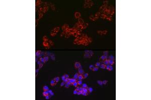 Immunofluorescence analysis of HepG2 cells using  Rabbit mAb (ABIN7265367) at dilution of 1:100 (40x lens). (ACAA2 anticorps)