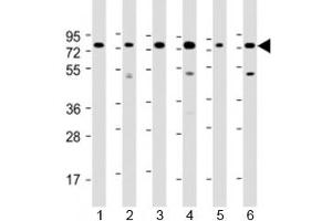Western blot testing of human 1) Daudi, 2) HepG2, 3) Jurkat, 4) K562, 5) MOLT-4 and 5) Raji cell lysate with PABPC3 antibody at 1:2000. (PABPC3 anticorps  (AA 84-117))