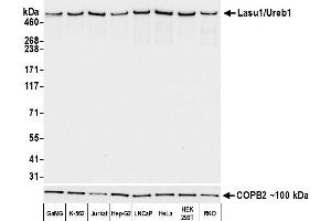 Western Blotting (WB) image for anti-HECT, UBA and WWE Domain Containing 1, E3 Ubiquitin Protein Ligase (HUWE1) (AA 2250-2300) antibody (ABIN7453974)