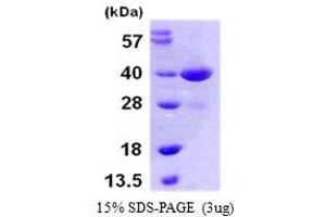 SDS-PAGE (SDS) image for Mitogen-Activated Protein Kinase Kinase 3 (MAP2K3) (AA 1-318) protein (His tag) (ABIN6386730)