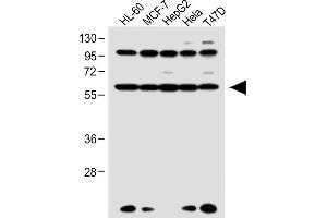 All lanes : Anti-RARA Antibody (C-term) at 1:1000 dilution Lane 1: HL-60 whole cell lysate Lane 2: MCF-7 whole cell lysate Lane 3: HepG2 whole cell lysate Lane 4: Hela whole cell lysate Lane 5: T47D whole cell lysate Lysates/proteins at 20 μg per lane. (Retinoic Acid Receptor alpha anticorps  (C-Term))