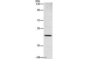 Western blot analysis of Human placenta tissue, using SIGLEC6 Polyclonal Antibody at dilution of 1:1000 (SIGLEC6 anticorps)