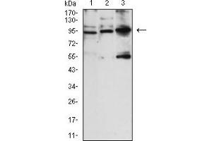 Western blot analysis using NCAM1 mouse mAb against SH-SY5Y (1), COS-7 (2), and NIH3T3 (3) cell lysate. (CD56 anticorps)
