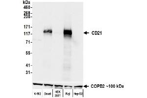 Western Blotting (WB) image for anti-Complement Component (3d/Epstein Barr Virus) Receptor 2 (CR2) (C-Term) antibody (ABIN7795815) (Recombinant CD21 anticorps  (C-Term))