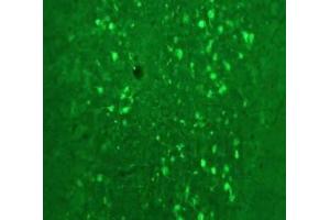 Immunofluorescence Microscopy of Anti-Calretinin (Sheep) Antibody Immunofluorescence Microscopy of Anti-Calretinin (Sheep) Antibody.