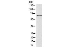 Western blot testing of human Jurkat lysate with CDC45 antibody at 0.