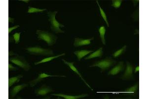 Immunofluorescence of purified MaxPab antibody to MDM4 on HeLa cell. (MDM4-binding Protein anticorps  (AA 1-490))