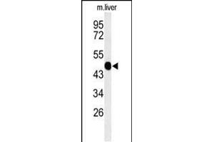 Western blot analysis of WAS Antibody (Center) (ABIN653830 and ABIN2843097) in mouse liver tissue lysates (35 μg/lane). (WASP anticorps  (AA 116-144))