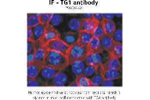 Image no. 1 for anti-Transglutaminase 1, Keratinocyte (TGM1) antibody (ABIN347015) (TGM1 anticorps)