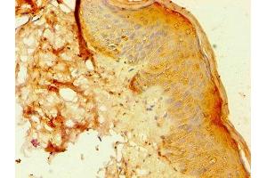 Immunohistochemistry of paraffin-embedded human skin tissue using ABIN7144295 at dilution of 1:100 (ANXA8L2 anticorps  (AA 1-276))