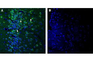 Expression of SEZ6 in mouse piriform cortex. (SEZ6 anticorps  (Extracellular))