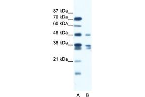 WB Suggested Anti-ZNF577 Antibody Titration:  1. (ZNF577 anticorps  (C-Term))