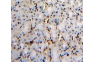 Used in DAB staining on fromalin fixed paraffin-embedded Kidney tissue (PHAP1 anticorps  (AA 2-175))