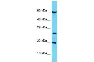 Host: Rabbit Target Name: C17orf102 Sample Type: MCF7 Whole Cell lysates Antibody Dilution: 1. (C17orf102 anticorps  (Middle Region))