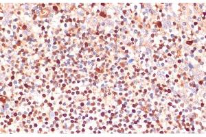 Immunohistochemistry of paraffin-embedded Human tonsil using ALOX5 Polyclonal Antibody at dilution of 1:100 (40x lens). (ALOX5 anticorps)