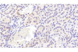 Detection of IL1RA in Human Kidney Tissue using Polyclonal Antibody to Interleukin 1 Receptor Antagonist (IL1RA)