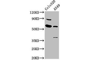 Western Blot Positive WB detected in: Colo320 whole cell lysate, A549 whole cell lysate All lanes: EBF3 antibody at 5. (EBF3 anticorps  (AA 416-530))