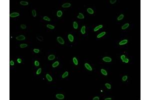Immunofluorescent analysis of Hela cells (sodium butyrate, 30 mM, 4h) using ABIN7139188 at dilution of 1:100 and Alexa Fluor 488-congugated AffiniPure Goat Anti-Rabbit IgG(H+L)