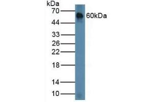 Detection of CHRD in Mouse Lung Tissue using Polyclonal Antibody to Chordin (CHRD)
