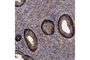Immunohistochemical staining of human prostate with TXNDC11 polyclonal antibody  shows distinct cytoplasmic positivity in glandular cells. (TXNDC11 anticorps)