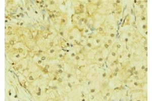 ABIN6272852 at 1/100 staining Mouse liver tissue by IHC-P. (DACH1 anticorps  (Internal Region))
