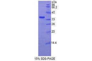 SDS-PAGE (SDS) image for Telomerase Reverse Transcriptase (TERT) (AA 673-976) protein (His tag) (ABIN1878403) (TERT Protein (AA 673-976) (His tag))
