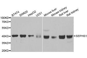 Western blot analysis of extracts of various cell lines, using SEPHS1 antibody. (SEPHS1 anticorps  (AA 1-392))