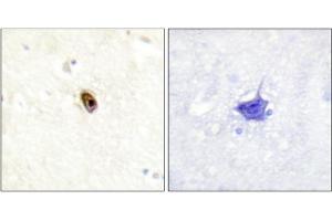 Immunohistochemistry analysis of paraffin-embedded human brain tissue using AurB/C (Phospho-Thr236/202) antibody. (Aurora Kinase C anticorps  (pThr202, pThr236))