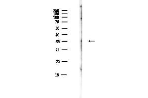 anti-Carbonic Anhydrase VIII (CA8) (C-Term) antibody