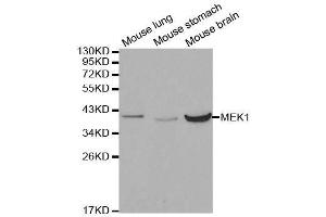 Western blot analysis of extracts of various cell lines, using MAP2K1 antibody. (MEK1 anticorps  (AA 1-100))
