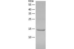 Western Blotting (WB) image for Tripartite Motif Containing 24 (TRIM24) (AA 896-1014) protein (His-IF2DI Tag) (ABIN7125497)