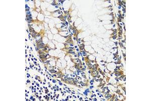 Immunohistochemistry of paraffin-embedded human colon using CCDC124 antibody  at dilution of 1:100 (40x lens). (CCDC124 anticorps  (AA 1-223))